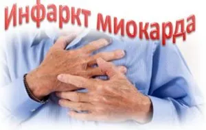 Операция след сърдечен удар Операция след сърдечен удар