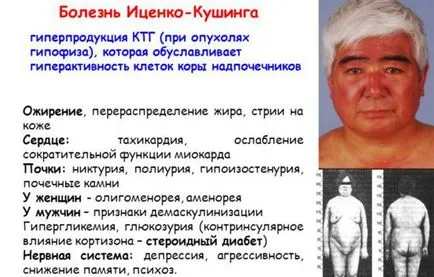 хипофизната жлеза на мозъка, че е