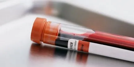 Както PCR се взема Както PCR се взема