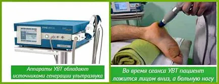 Как за лечение на шип