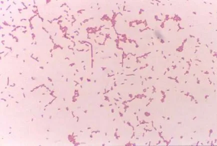 Proteus Mirabilis какво е Proteus Mirabilis какво е