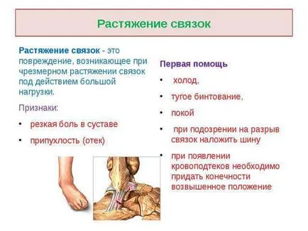 За лечение на сухожилие разкъсвания