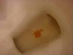 Слузта от ануса го