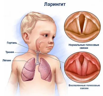 Най-дрезгав глас дете какво да правя Най-дрезгав глас дете какво да правя