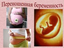 Как да се избегне бременност perehazhivat