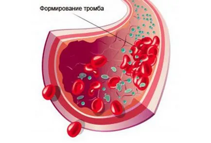 Какво трябва да направя, за да се отстрани зъб боли