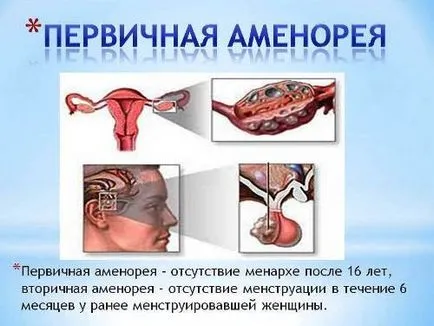 Какво става, ако проблеми момиче