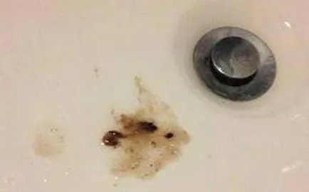 Какво означава цвета на храчки