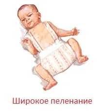 Хип дисплазия при деца снимка, лечение, последствията от TPA