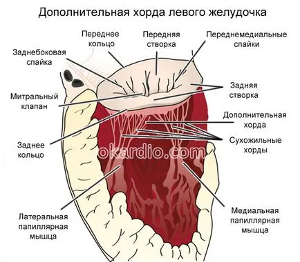 Допълнителна акорд на лявата камера води, видове, симптоми и лечение