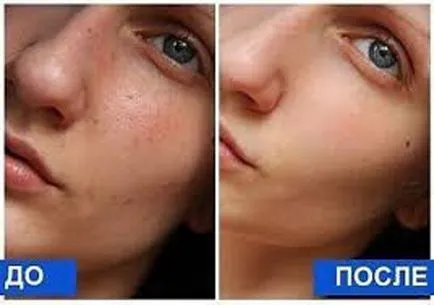 Дълбоко почистване на лицето у дома рецепти (почистване) Дълбоко почистване на лицето условия у дома рецепти