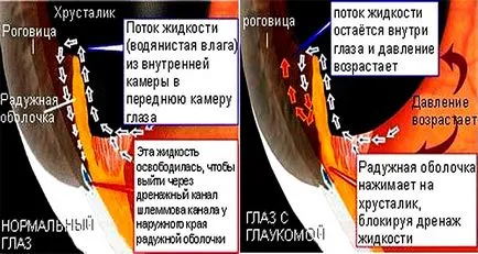 Как да се измери очното налягане в домашни устройства и монитори за кръвно налягане