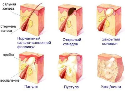 Как да се почисти лицето на дома народни средства за защита (у дома) Как да се почисти лицето на дома народни средства