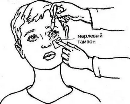 Как да погребе капки в очите на очите, детето и новороденото