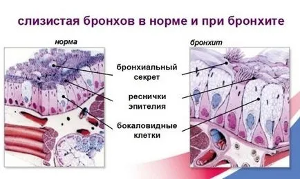Като методи за показване на храчки от бронхите и препарати