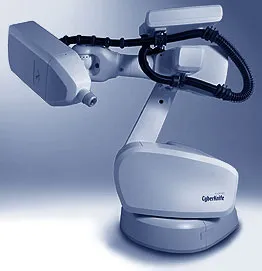 CyberKnife - модерен метод за радиохирургия тумори