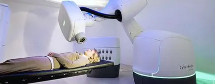 Cyber ​​нож (cyberknife), лечение на рак cyberknife