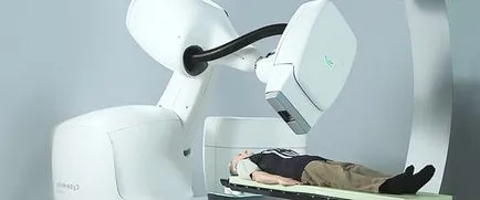 Cyber ​​нож (cyberknife), лечение на рак cyberknife
