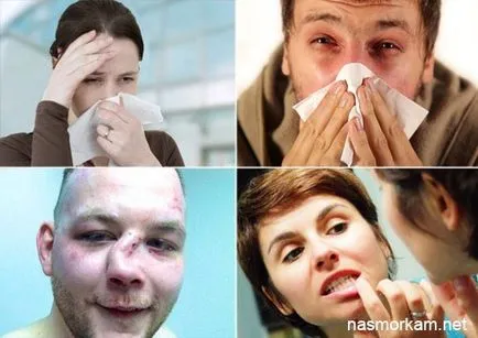 Киста в носа (назални синуси) симптоми, лечение, последици