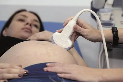Възможно ли е да се направи ултразвук по време на менструация препоръки