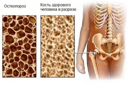 Болки краката причини за болка и какво да правя