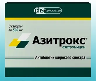 Лечение на двустранен синузит