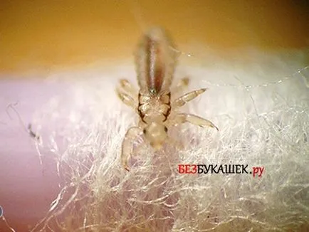 Как да се отървем от въшки при дете
