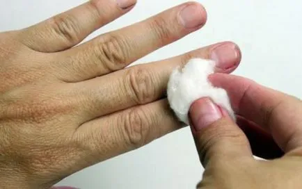 Изплакването Зеленка от кожата по-бързо да го премахнете от ръцете, тялото, лицето