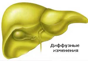 Какво е дифузни и огнищни промени