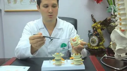 Какво е chondrosis и как да се лекува