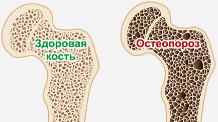 Калций в липсата на орган на излишните продукти