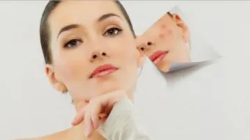 Хормонални хапчета за акне за жените и мъжете (хормонални) Хормонални хапчета за акне на жените и мъжете