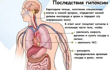 церебрална хипоксия какво е, липсата на кислород, симптоми, лечение