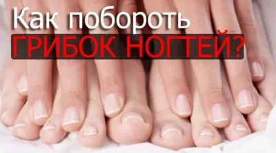 Как бързо да се отървете от гъбички на ноктите на краката си у дома народни средства