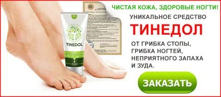 Как бързо да се отървете от гъбички на ноктите на краката си у дома народни средства