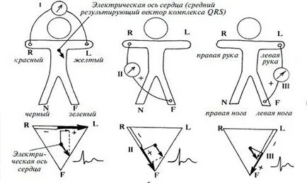 Как се прави ЕКГ