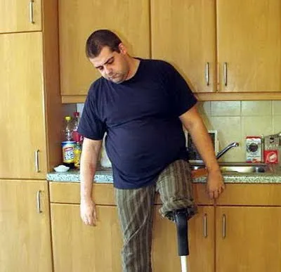 Докато мъжът загубил крака си, имам вкус, и започна да се отреже собствените си крайници (снимка) -