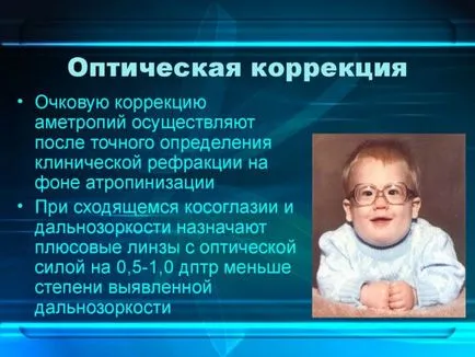 Как за лечение на кривогледство при възрастни и деца причини и лечение в домашни условия на Бейтс