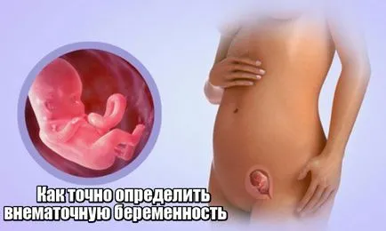 Как да се установи извънматочна бременност в ранните етапи на диагностика и откриване в ранните етапи