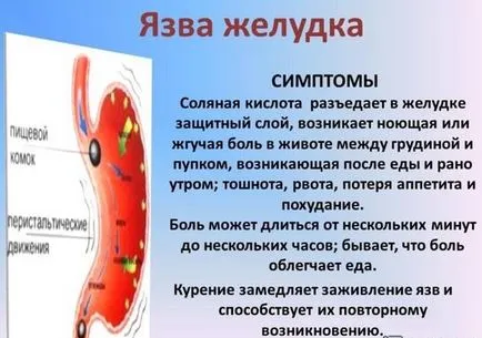 Откъде знаеш, че стомахът ме боли - където е и неговите симптоми!