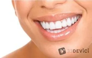 Lingual скоби система - цени, коментари, специални характеристики