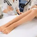 Как да премахнете подмишниците у дома