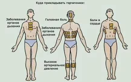 Как да се сложи горчица деца с кашлица и други болести