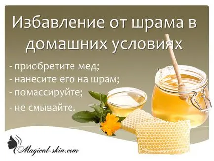 Как да премахнете белези от съкращения в страната (чисти разрези белези) Как да премахнете белези от съкращения в страната
