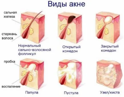 Как да се съгласуват методите си за подравняване лицето на облекчение на лицето си (на лицето) Как да се съгласуват методите си за подравняване лицето на облекчение на лицето си
