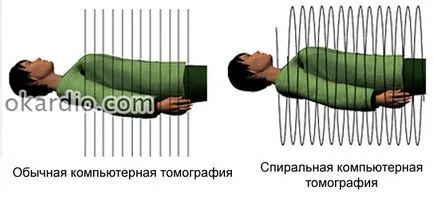 Малформация на мозъка и други плавателни съдове, причини и лечение