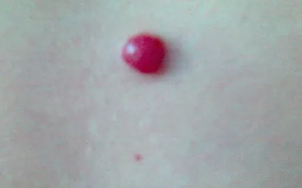 Червени петна по тялото снимка, причини, лечение, кожни заболявания