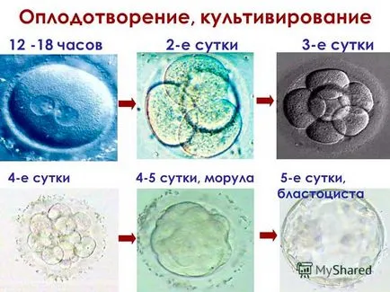 Отглеждането на ембриони - което е фото и видео