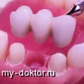 Лечението с електромагнитни вълни