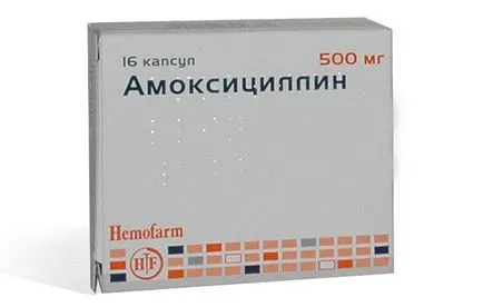 Лечение на болки в гърлото с антибиотици